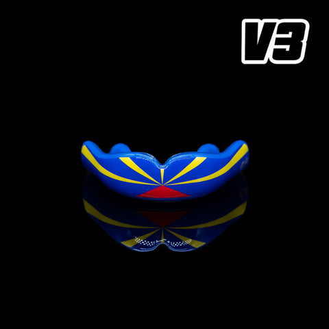 [imparfait] V3 La Réunion