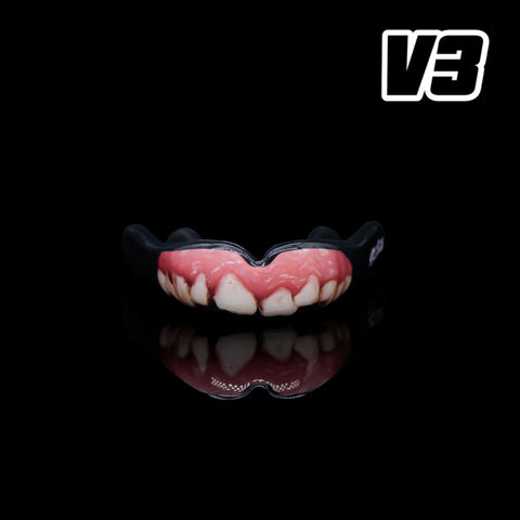 V3 Dents pourries